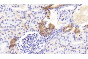 Detection of EFNB2 in Human Kidney Tissue using Polyclonal Antibody to Ephrin B2 (EFNB2) (Ephrin B2 Antikörper)