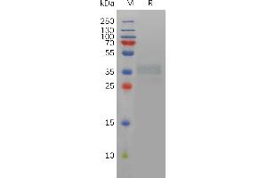 Human A Protein, His Tag on SDS-PAGE under reducing condition.