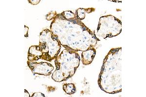 Immunohistochemistry of paraffin-embedded Human placenta using Cytokeratin 19 (KRT19) antibody (ABIN7268099) at dilution of 1:100 (40x lens). (Cytokeratin 19 Antikörper)