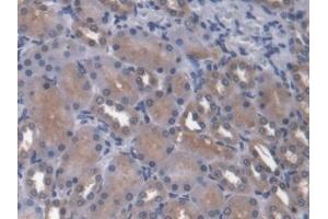 IHC-P analysis of Rat Kidney Tissue, with DAB staining. (ANGPTL4 Antikörper  (AA 228-389))