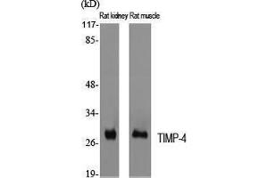 Western Blotting (WB) image for anti-TIMP Metallopeptidase Inhibitor 4 (TIMP4) (C-Term) antibody (ABIN3177728) (TIMP4 Antikörper  (C-Term))
