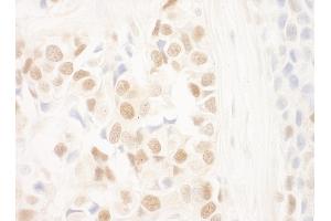 anti-DDB1 and CUL4 Associated Factor 6 (DCAF6) (AA 600-650) antibody