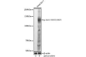 Western blot analysis of extracts of R. (JAK1 Antikörper  (pTyr1022, pTyr1023))