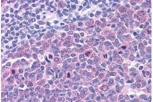 Human Tonsil: Formalin-Fixed, Paraffin-Embedded (FFPE) (SMARCA4 Antikörper  (C-Term))