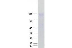 Western Blotting (WB) image for Ectonucleotide Pyrophosphatase/phosphodiesterase 1 (ENPP1) protein (Myc-DYKDDDDK Tag) (ABIN2720201)