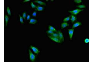 Immunofluorescent analysis of HepG2 cells using ABIN7171408 at dilution of 1:100 and Alexa Fluor 488-congugated AffiniPure Goat Anti-Rabbit IgG(H+L) (CD96 Antikörper  (AA 306-395))