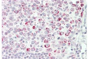 Rabbit Anti-CSTF2 antibody  Formalin Fixed Paraffin Embedded Tissue: Human Tonsil Primary antibody Concentration: 1:100 Secondary Antibody: Donkey anti-Rabbit-Cy3 Secondary Antibody Concentration: 1:200 Magnification: 20x Exposure Time: 0. (CSTF2 Antikörper  (N-Term))