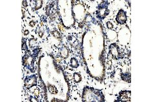 IHC analysis of TBX18 using anti-TBX18 antibody (ABIN7599494).