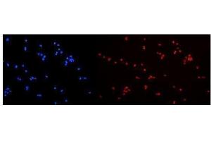 IF analysis of hnRNP A2B1 using anti-hnRNP A2B1 antibody (ABIN5692872).