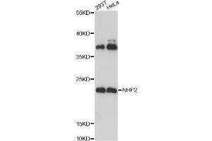 Western blot analysis of extracts of various cell lines, using NHP2 Antibody. (NHP2 Antikörper)