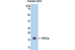Western blot analysis of the recombinant protein. (Fascin Antikörper  (AA 277-396))