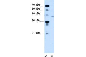 Western Blotting (WB) image for anti-Fukutin (FKTN) antibody (ABIN2464004) (Fukutin Antikörper)