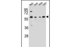 CEP70 Antibody (Center) (ABIN654603 and ABIN2844302) western blot analysis in WiDr,CHO,A549, cell line lysates (35 μg/lane).