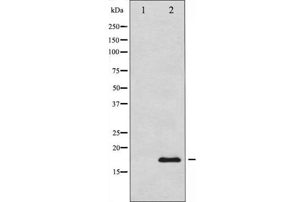 Calmodulin 1 Antikörper