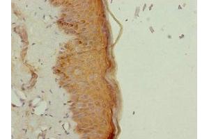 Immunohistochemistry (IHC) image for anti-Nuclear Receptor Subfamily 2, Group E, Member 1 (NR2E1) (AA 106-385) antibody (ABIN7161905)