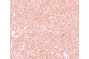 Immunohistochemical staining of human brain cells with NLRP10 polyclonal antibody  at 10 ug/mL.