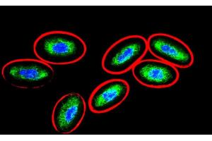 Immunofluorescence staining (chicken erythrocytes) (Vimentin Antikörper)