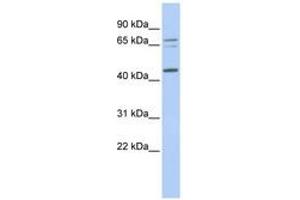 Image no. 1 for anti-Queuine tRNA-Ribosyltransferase 1 (QTRT1) (AA 252-301) antibody (ABIN6741051) (QTRT1 Antikörper  (AA 252-301))