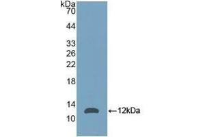 Detection of Recombinant NPM, Mouse using Polyclonal Antibody to Nucleophosmin 1 (NPM1) (NPM1 Antikörper  (AA 212-292))