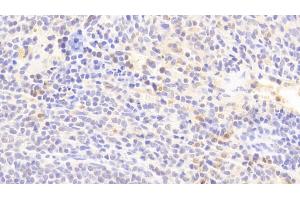 Immunohistochemistry (IHC) image for anti-Interleukin 1 Receptor Antagonist (IL1RN) (AA 26-177) antibody (APC) (ABIN7431377)