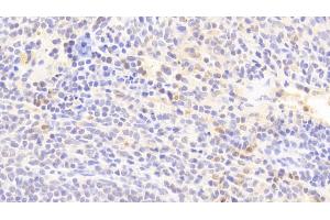 Detection of IL1RA in Rabbit Spleen Tissue using Polyclonal Antibody to Interleukin 1 Receptor Antagonist (IL1RA)