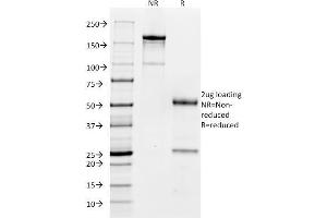 SDS-PAGE Analysis Purified CD32 Mouse Monoclonal Antibody (FCGR2A/479). (FCGR2A Antikörper)