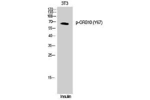 Western Blotting (WB) image for anti-Growth Factor Receptor-Bound Protein 10 (GRB10) (pTyr67) antibody (ABIN3182445)