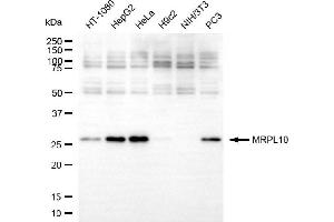 Western blotting analysis using MRPL10 antibody (ABIN7799429).