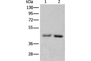 Western blot analysis of A549 and Hela cell lysates using NADK2 Polyclonal Antibody at dilution of 1:1000 (NADK2 Antikörper)