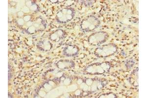 Immunohistochemistry of paraffin-embedded human small intestine tissue using ABIN7145334 at dilution of 1:100 (SLC22A18AS Antikörper  (AA 1-150))