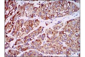 Image no. 3 for anti-Chemokine (C-C Motif) Ligand 2 (CCL2) antibody (ABIN1497128)