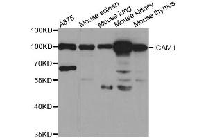 Western Blotting (WB) image for anti-Intercellular Adhesion Molecule 1 (ICAM1) antibody (ABIN1876800) (ICAM1 Antikörper)