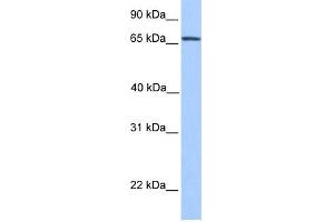 Western Blotting (WB) image for anti-Nuclear Receptor Subfamily 4, Group A, Member 2 (NR4A2) (N-Term) antibody (ABIN2780752)