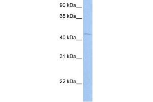 WB Suggested Anti-ZBTB6 Antibody Titration:  0. (ZBTB6 Antikörper  (N-Term))