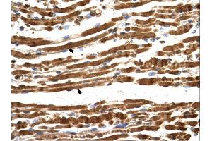 Immunohistochemistry (IHC) image for anti-N(alpha)-Acetyltransferase 16, NatA Auxiliary Subunit (NAA16) (Middle Region) antibody (ABIN311101) (NARG1L Antikörper  (Middle Region))