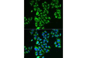 Immunofluorescence analysis of A549 cell using GLUD2 antibody. (GLUD2 Antikörper)