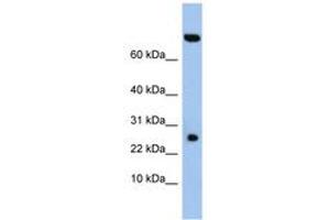 Image no. 1 for anti-Zinc Finger, SWIM-Type Containing 3 (ZSWIM3) (AA 35-84) antibody (ABIN6743750) (ZSWIM3 Antikörper  (AA 35-84))