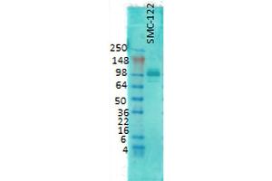 Western Blot analysis of Rat brain membrane lysate showing detection of PSD95 protein using Mouse Anti-PSD95 Monoclonal Antibody, Clone 6G6 .