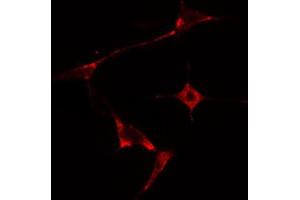 ABIN6274672 staining HepG2 cells by IF/ICC. (HSPB2 Antikörper  (Internal Region))