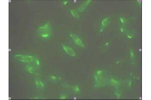 Immunofluorescence (IF) image for anti-Six Transmembrane Epithelial Antigen of The Prostate 1 (STEAP1) (AA 1-70), (N-Term) antibody (ABIN317568) (STEAP1 Antikörper  (N-Term))