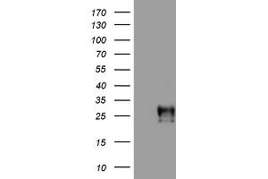 Western Blotting (WB) image for anti-Adiponectin (ADIPOQ) (AA 19-244) antibody (ABIN2715769) (ADIPOQ Antikörper  (AA 19-244))
