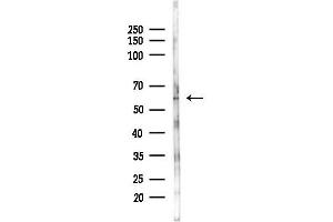 Western blot analysis of lysates from Mouse lung, using ACVR2B Antibody at 1/1000 dilution.