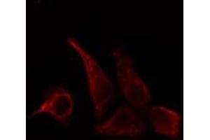 ABIN6278649 staining HepG2 cells by IF/ICC. (CD28 Antikörper  (pTyr218))