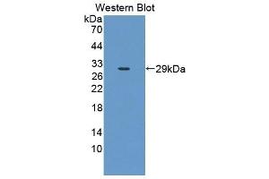 Detection of Recombinant CLTA, Mouse using Polyclonal Antibody to Clathrin, Light Polypeptide A (CLTA) (CLTA Antikörper  (AA 5-234))