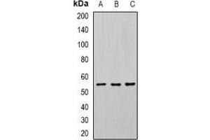 Western blot analysis of U2AF65 expression in Jurkat (A), SW620 (B), mouse spleen (C) whole cell lysates. (U2AF2 Antikörper)