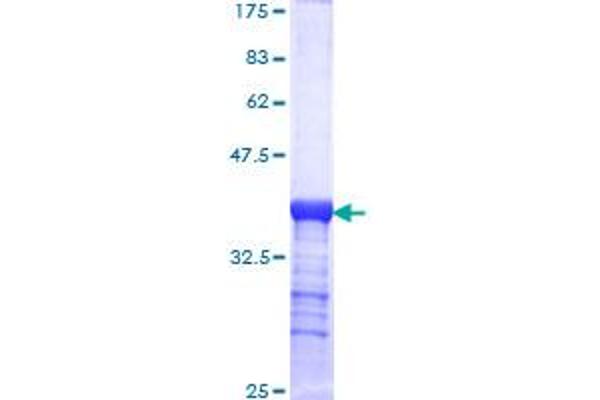 LAMC2 Protein (AA 1084-1193) (GST tag)