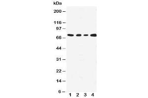 Western blot testing with MEKK3 antibody (MAP3K3 Antikörper  (N-Term))