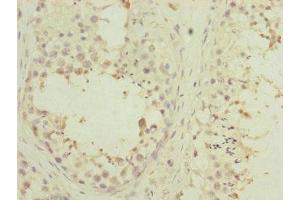 Immunohistochemistry of paraffin-embedded human testis tissue using ABIN7166900 at dilution of 1:100 (PDHA2 Antikörper  (AA 119-388))