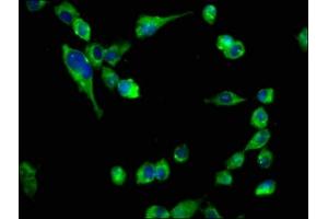 Immunofluorescence (IF) image for anti-Cholinergic Receptor, Nicotinic, beta 2 (Neuronal) (CHRNB2) (AA 322-458) antibody (ABIN7161352)