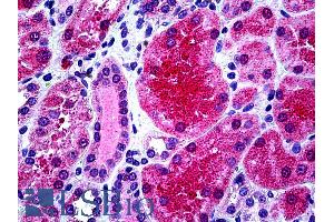 ABIN6391378 (3. (KCNN4 Antikörper  (Internal Region))